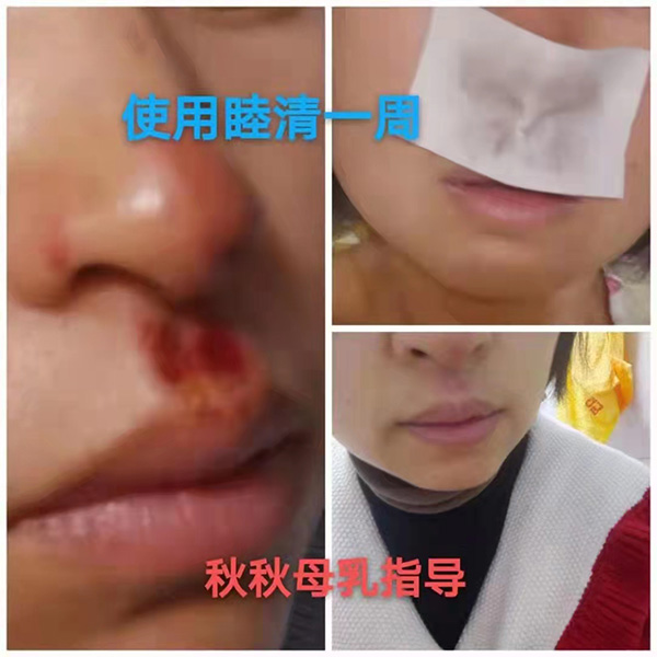 �����澏���N���Æ������M�߿ڱ������������a(ch��n)ƷȦ�۟o��(sh��)